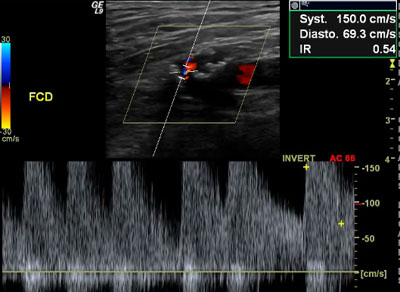 Pertinence des soins en echo-doppler