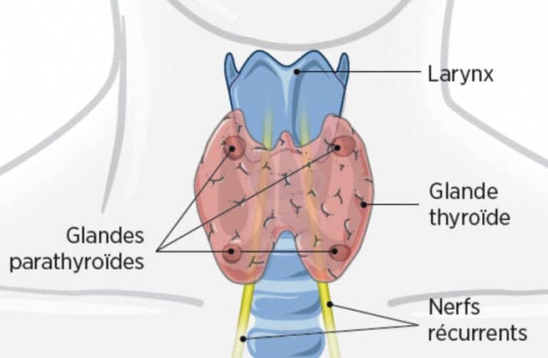 Pathologie cervicale extra vasculaire